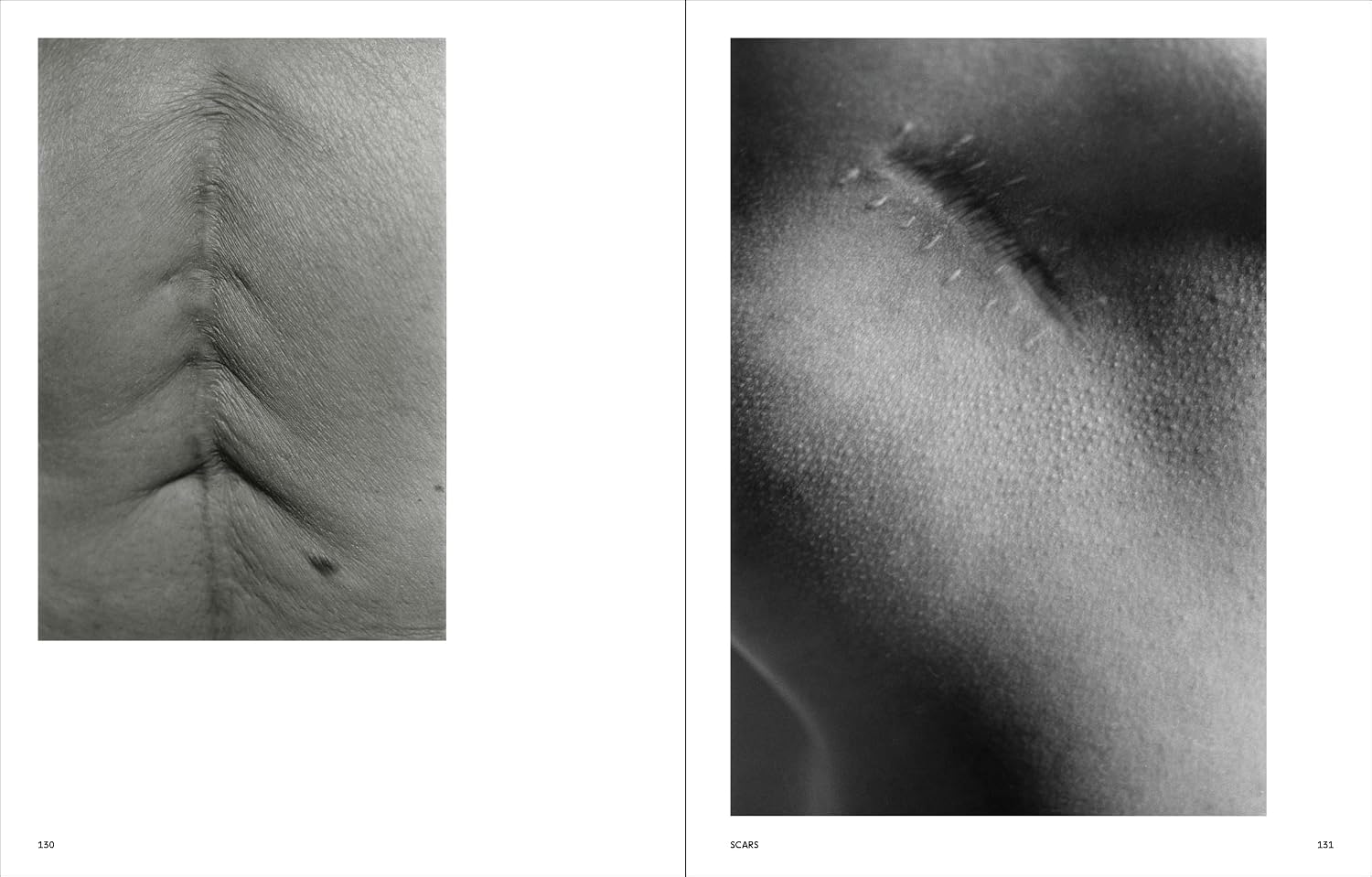 Ishiuchi Miyako: Traces